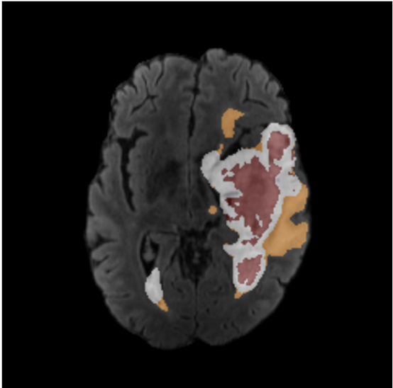 BraTS Quality Control